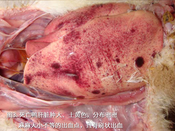 死亡鴨肝臟腫大、土黃色，分布密密麻麻大小不等的出血點，且有刷狀出血